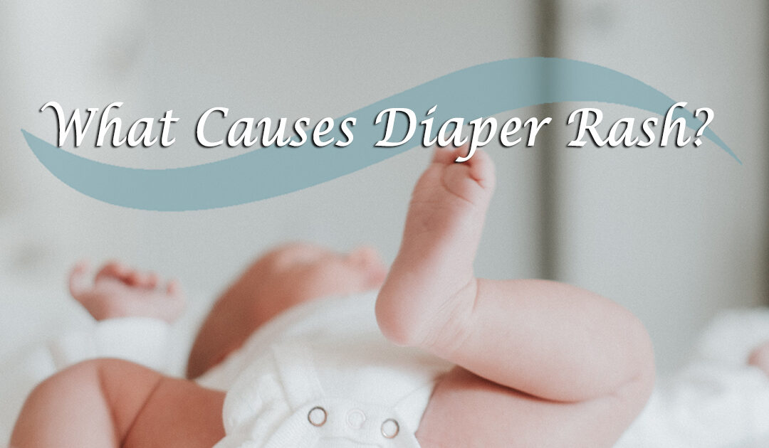 What Causes Diaper Rash?