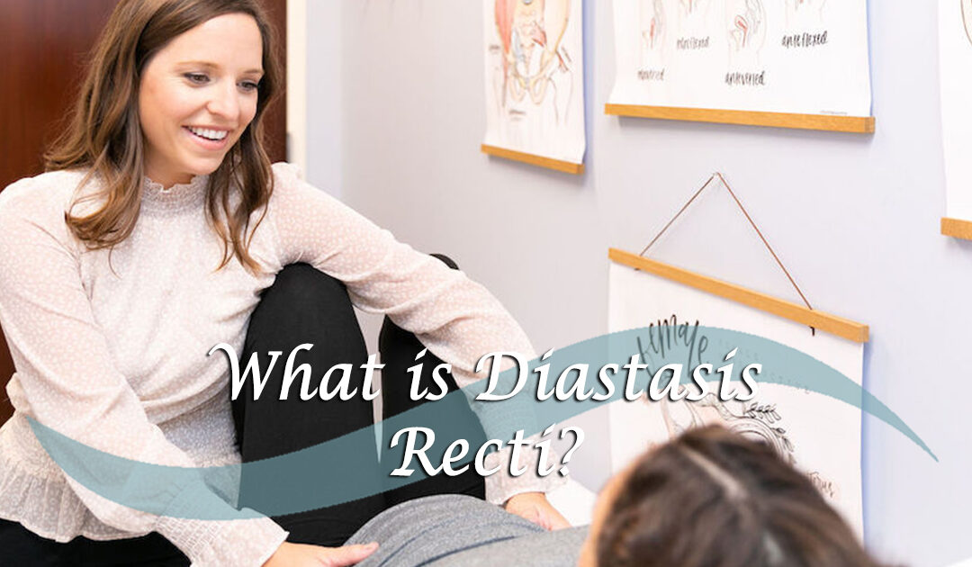 What is Diastasis Recti?