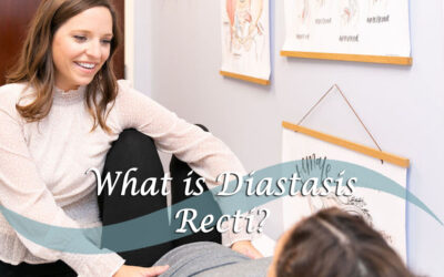 What is Diastasis Recti?